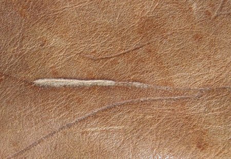 Leather: injuries