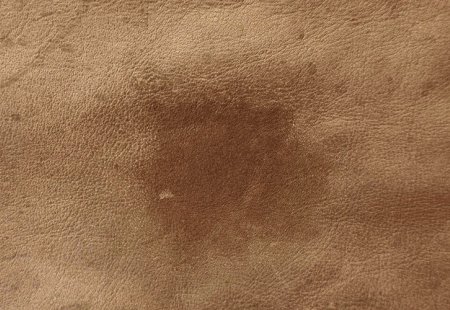 Leather: skin abscess